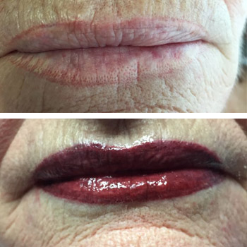 Lippenkorrektur