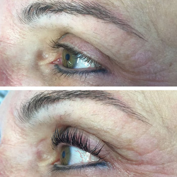 Wimpernlifting